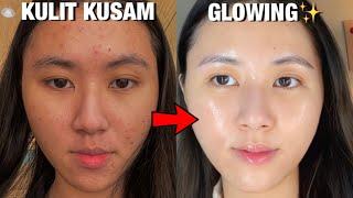 5 CARA AMPUH Untuk KULIT CERAH & GLOWING || Dari Kusam jadi Glowing! 