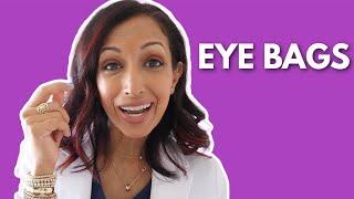 Eye Doctor Explains 5 Ways to Prevent Under Eye Bags & Circles