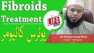 Fibroids Treatment with Quran Therapy | Life Skills TV