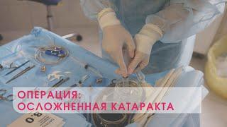 Факоэмульсификация осложненной катаракты с имплантацией интраокулярной линзы