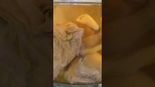 Amazing Human Fetus