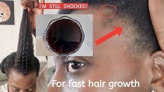 HOW TO GROW YOUR EDGES|NATURAL HAIR GROWTH TIPS|4C HAIR|HOW TO GROW YOUR HAIR WITH CLOVES|ALOPECIA