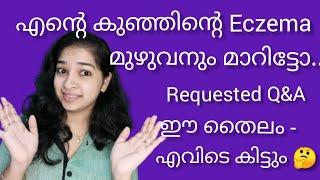 Baby Eczema Natural Treatment| sure results|Q&A|Really Works Dasapushpathilam?|Priya’s Magic World