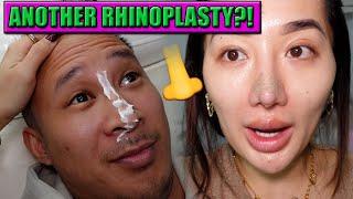 ANOTHER RHINOPLASTY...   VLOG WEEK 143