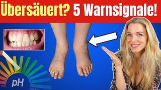 5 Anzeichen, dass dein Körper ÜBERSÄUERT ist! Fatale Folgen & Prävention