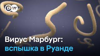 Вспышка смертельно опасного вируса Марбург в Руанде - глобальная угроза?