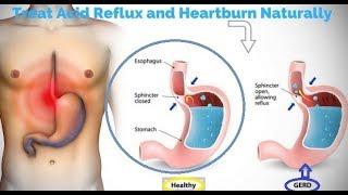 lifestyle to keep body 100% free from acidity