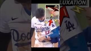 Doctor explains Shohei Ohtani shoulder subluxation in 60 seconds #worldseries #dodgers #ohtani