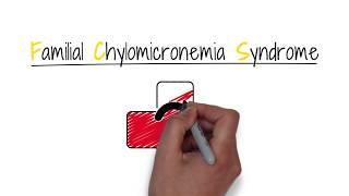 Familial chylomicronemia syndrome (FCS)