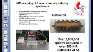 Coronary Near-Infrared Spectroscopy Review - part 1