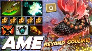 Ame Juggernaut Beyond Godlike - Dota 2 Pro Gameplay [Watch & Learn]