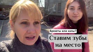 VLOG  Брекеты или капы? Ставим зубы на место. Что такое элайнеры?