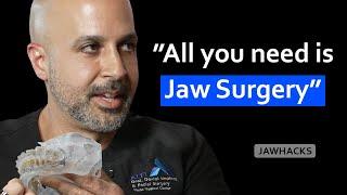 Jaw Surgery vs. MARPE: The Ultimate Solution for Airway