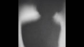 [INSOMNIA]:(5) INTERLUDE