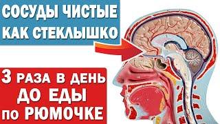 Чистка сосудов от холестерина и от тромбов в домашних условиях народными средствами без лекарств