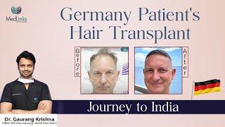 From Germany to India: Life-Changing Hair Transplant Journey at MedLinks | Hair Transplant in Delhi