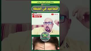 وصفة تجاعيد الجبهة من عند الدكتور عماد ميزاب / #dr_imad_mizab