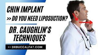 Chin Implant | Chin Augmentation / Chin Defining | Maybe you don't need liposuction - Dr. Caughlin