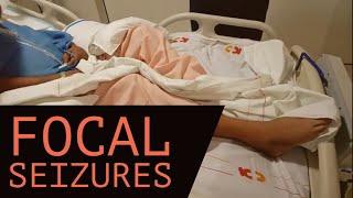 Focal seizures | Focal seizure epilepsy | Types of seizure