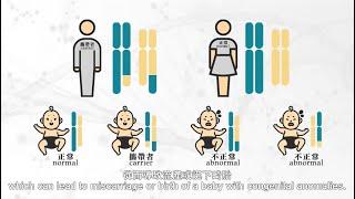 慣性流產 Recurrent Miscarriage