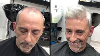 Hair Replacement fitting video (Germán) – Hair Inspira