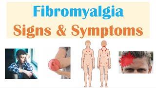 Fibromyalgia | Signs & Symptoms, Associated Conditions