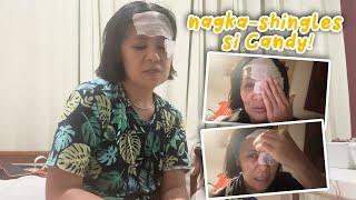 NAGKA-SHINGLES SI CANDY! | CANDY AND QUENTIN | OUR SPECIAL LOVE