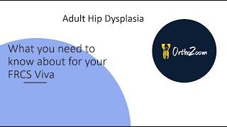 Adult hip dysplasia : What you need to know for your FRCS viva