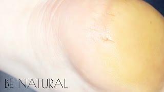 Средство для педикюра Be natural