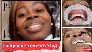 Behind the Scenes: My Dental Journey to Composite Veneers #DentalJourney #SmileTransformation