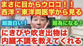 目からウロコ！ニキビ、吹き出物、肌の異常が教えてくれる内臓の疲労を西洋、東洋両医学から皆様に！