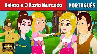 Beleza e O Rosto Marcado - Historinha Infantil | Contos de Fadas | Historinhas para dormir