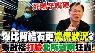 【全程字幕】柯文哲健康亮紅燈仍在押!張啟楷曝比腎結石更讓北所"驚慌狀況"...攤開聲明一一打臉"怒轟:"死鴨子嘴硬"
