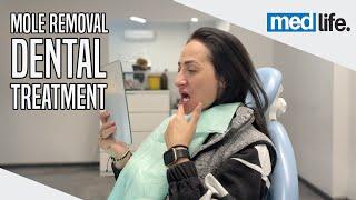 Ramona's Medical Journey in Turkey | Mole Removal & Dental Treatment