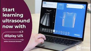 diSplay U/S - Online ultrasound simulator