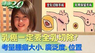 乳癌一定要全乳切除？ 考量腫瘤大小.廣泛度.位置 健康2.0