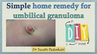 Umbilical granuloma in babies | Simple do-it-yourself home remedy
