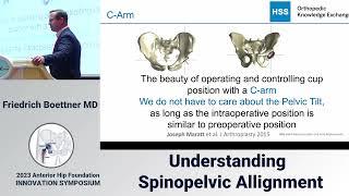 Understanding the spino-pelvic relationship: Dr. Friedrich Boettner #AHF2023