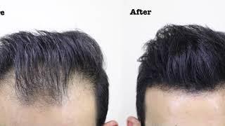 Conceal Thinning Hair with THICK FIBER- Hair Building Fibers