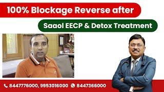 Testimonial #107: 100% Blockage Reverse after Saaol EECP & Detox Treatment | SAAOL