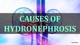 CAUSES OF HYDRONEPHROSIS