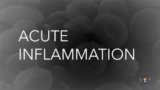 急性炎症 Acute Inflammation  Educational 3D Animation （中文字幕）