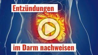 Entzündungen im Darm nachweisen mit einem einfachen Stuhltest