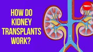 How do kidney transplants work? - Alexander H. Toledo