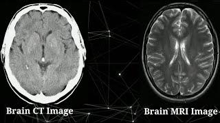What's the difference between MRI and CT Scan? || Radiology Buzz