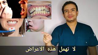 5 اعراض شهيره تدل ان اسنانك و لثتك بها مشكله و ليست صحيه