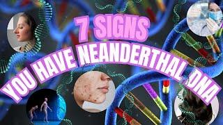 7 Signs You Have Neanderthal DNA