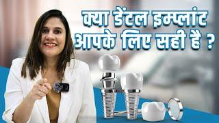 Kya Dental Implants aapke liye right choice hai? What are Dental Implants