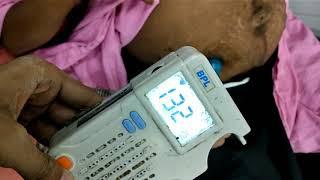 Fetal Doppler Study || FHS || Gynecology  & Obstetrics