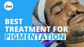 Best Treatment For Pigmentation | Melanin Break Therapy | VCare